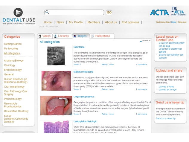 Overzicht afbeedlingen DentalTube